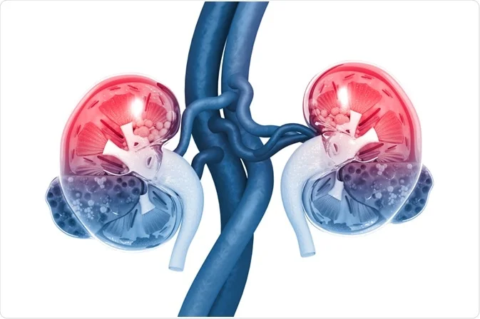 NUTRITION  FOR  ACUTE  KIDNEY  DISEASE